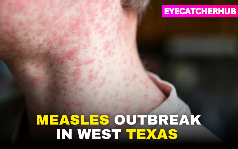 Measles Outbreak In West Texas